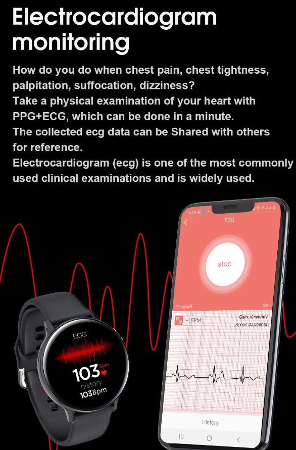 S20S Smartwatch with Health Monitoring - White