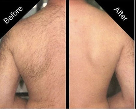 Men's Back Shaver Retractable