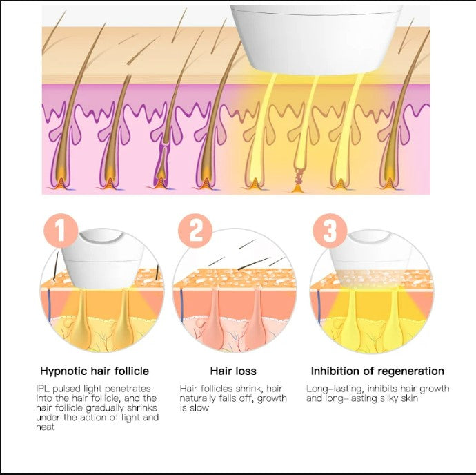 IPL Laser Hair Removal - Black